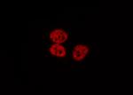 Phospho-STAT4 (Ser721) Antibody in Immunocytochemistry (ICC/IF)