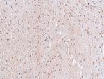 Phospho-STAT4 (Ser721) Antibody in Immunohistochemistry (Paraffin) (IHC (P))