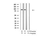 Phospho-STAT4 (Ser721) Antibody in Western Blot (WB)