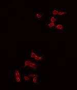 Phospho-VEGF Receptor 1 (Tyr1242) Antibody in Immunocytochemistry (ICC/IF)