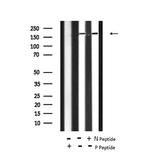 Phospho-VEGF Receptor 1 (Tyr1242) Antibody in Western Blot (WB)