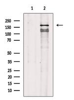 Phospho-VEGF Receptor 1 (Tyr1242) Antibody in Western Blot (WB)