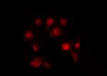 Phospho-JAK2 (Tyr119) Antibody in Immunocytochemistry (ICC/IF)