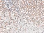 Phospho-p70 S6 Kinase (Ser427) Polyclonal Antibody