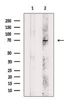 Phospho-p70 S6 Kinase (Ser427) Antibody in Western Blot (WB)