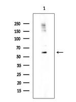 Phospho-p70 S6 Kinase (Ser427) Antibody in Western Blot (WB)