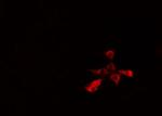Phospho-PKC theta (Tyr90) Antibody in Immunocytochemistry (ICC/IF)