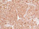 Phospho-cGKII (Ser126) Antibody in Immunohistochemistry (Paraffin) (IHC (P))