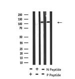 Phospho-TEK (Ser1119) Antibody in Western Blot (WB)