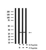 Phospho-LAT (Tyr161) Antibody in Western Blot (WB)