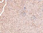 Phospho-RARA/RARB (Ser96) Antibody in Immunohistochemistry (Paraffin) (IHC (P))