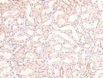 Phospho-RARA/RARB (Ser96) Antibody in Immunohistochemistry (Paraffin) (IHC (P))