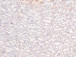Phospho-RARA/RARB (Ser96) Antibody in Immunohistochemistry (Paraffin) (IHC (P))