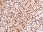 Phospho-Dystroglycan (Tyr892) Antibody in Immunohistochemistry (Paraffin) (IHC (P))