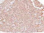 Phospho-Dystroglycan (Tyr892) Antibody in Immunohistochemistry (Paraffin) (IHC (P))
