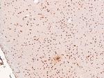 Phospho-Dystroglycan (Tyr892) Antibody in Immunohistochemistry (Paraffin) (IHC (P))