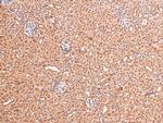 Phospho-FGFR1/FGFR2 (Tyr730, Tyr733) Antibody in Immunohistochemistry (Paraffin) (IHC (P))