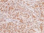 Phospho-Acinus (Ser1180) Antibody in Immunohistochemistry (Paraffin) (IHC (P))