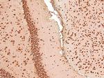 Phospho-Acinus (Ser1180) Antibody in Immunohistochemistry (Paraffin) (IHC (P))