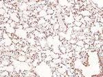 Phospho-Acinus (Ser1180) Antibody in Immunohistochemistry (Paraffin) (IHC (P))