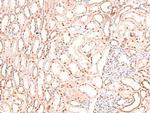 Phospho-BIK (Ser35) Antibody in Immunohistochemistry (Paraffin) (IHC (P))