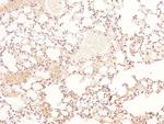 Phospho-BIK (Ser35) Antibody in Immunohistochemistry (Paraffin) (IHC (P))
