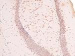 Phospho-Claspin (Ser30) Antibody in Immunohistochemistry (Paraffin) (IHC (P))