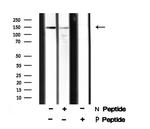 Phospho-Claspin (Ser30) Antibody in Western Blot (WB)