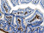 Phospho-delta Catenin (Tyr904) Polyclonal Antibody