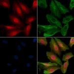 Phospho-FOXO3A (Ser318) Polyclonal Antibody