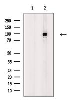 Phospho-FOXO3A (Ser318) Antibody in Western Blot (WB)