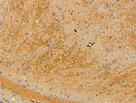 Phospho-RGS19 (Ser151) Polyclonal Antibody