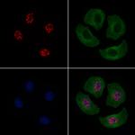 Phospho-JDP2 (Thr148) Antibody in Immunocytochemistry (ICC/IF)