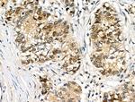 Phospho-JDP2 (Thr148) Antibody in Immunohistochemistry (Paraffin) (IHC (P))