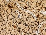 Phospho-JDP2 (Thr148) Antibody in Immunohistochemistry (Paraffin) (IHC (P))