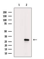 Phospho-JDP2 (Thr148) Antibody in Western Blot (WB)