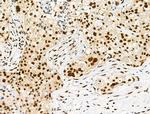Phospho-LIMK1 (Ser310) Polyclonal Antibody