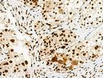 Phospho-LIMK1 (Ser310) Antibody in Immunohistochemistry (Paraffin) (IHC (P))