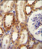 CD73 Antibody in Immunohistochemistry (Paraffin) (IHC (P))