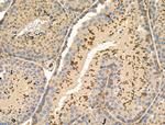 Phospho-NACA (Ser43) Polyclonal Antibody