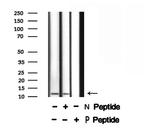 Phospho-PDE6 gamma (Thr22) Antibody in Western Blot (WB)
