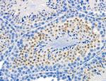 Phospho-Presenilin 1 (Ser353) Polyclonal Antibody