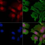 Phospho-RAD23A (Ser357) Polyclonal Antibody