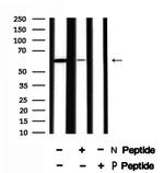 Phospho-SGOL1 (Ser14) Antibody in Western Blot (WB)