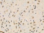 Phospho-TAB1 (Ser438) Antibody in Immunohistochemistry (Paraffin) (IHC (P))