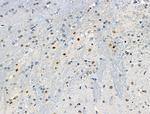 Phospho-ETV6 (Ser257) Antibody in Immunohistochemistry (Paraffin) (IHC (P))