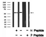Phospho-ETV6 (Ser257) Antibody in Western Blot (WB)