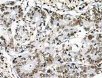 Phospho-POLR2A (Ser2, Ser1616) Antibody in Immunohistochemistry (Paraffin) (IHC (P))