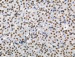 Phospho-POLR2A (Ser2, Ser1616) Antibody in Immunohistochemistry (Paraffin) (IHC (P))
