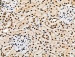 Phospho-POLR2A (Ser2, Ser1616) Antibody in Immunohistochemistry (Paraffin) (IHC (P))